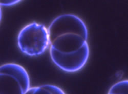 6-echinocytes